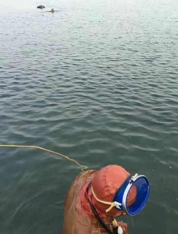 【人气整形】北京亚馨美莱坞何照华医生的颧骨颧弓前段磨削术|BJL平台(图2) BJL平台官网